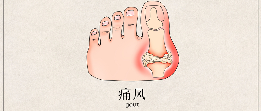 攝圖網_401790423_wx_痛風醫療插畫（非企業商用）.jpg